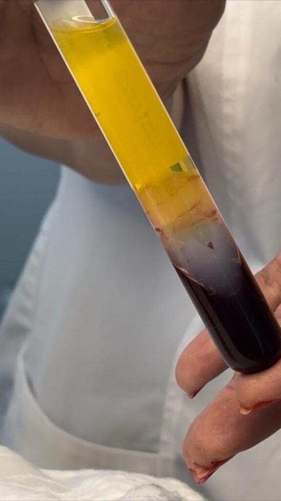 azzam-medecine-regenerative Soin de médecine régénérative du cuir chevelu